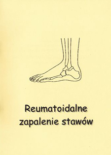 Stawy Stawy